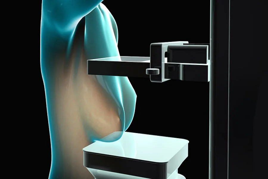 Argentinos diseñaron un mamógrafo que no requiere de rayos X