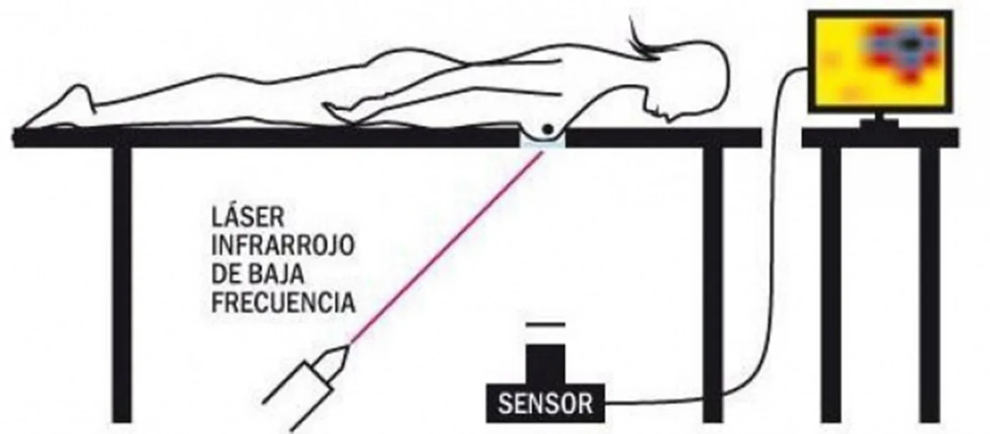 Mamógrafo diseñado por cientificos argentinos