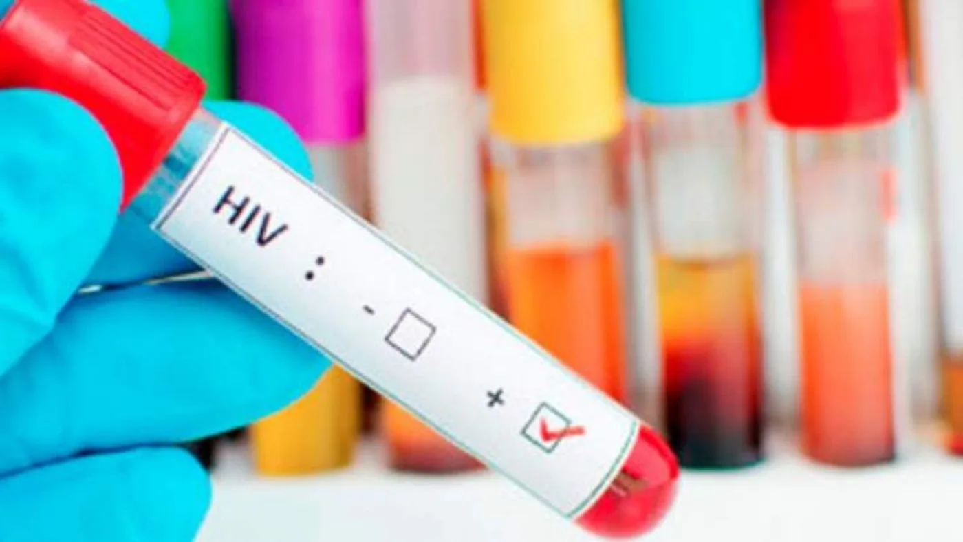 Cientificos logran por segunda vez curar a un paciente con VIH