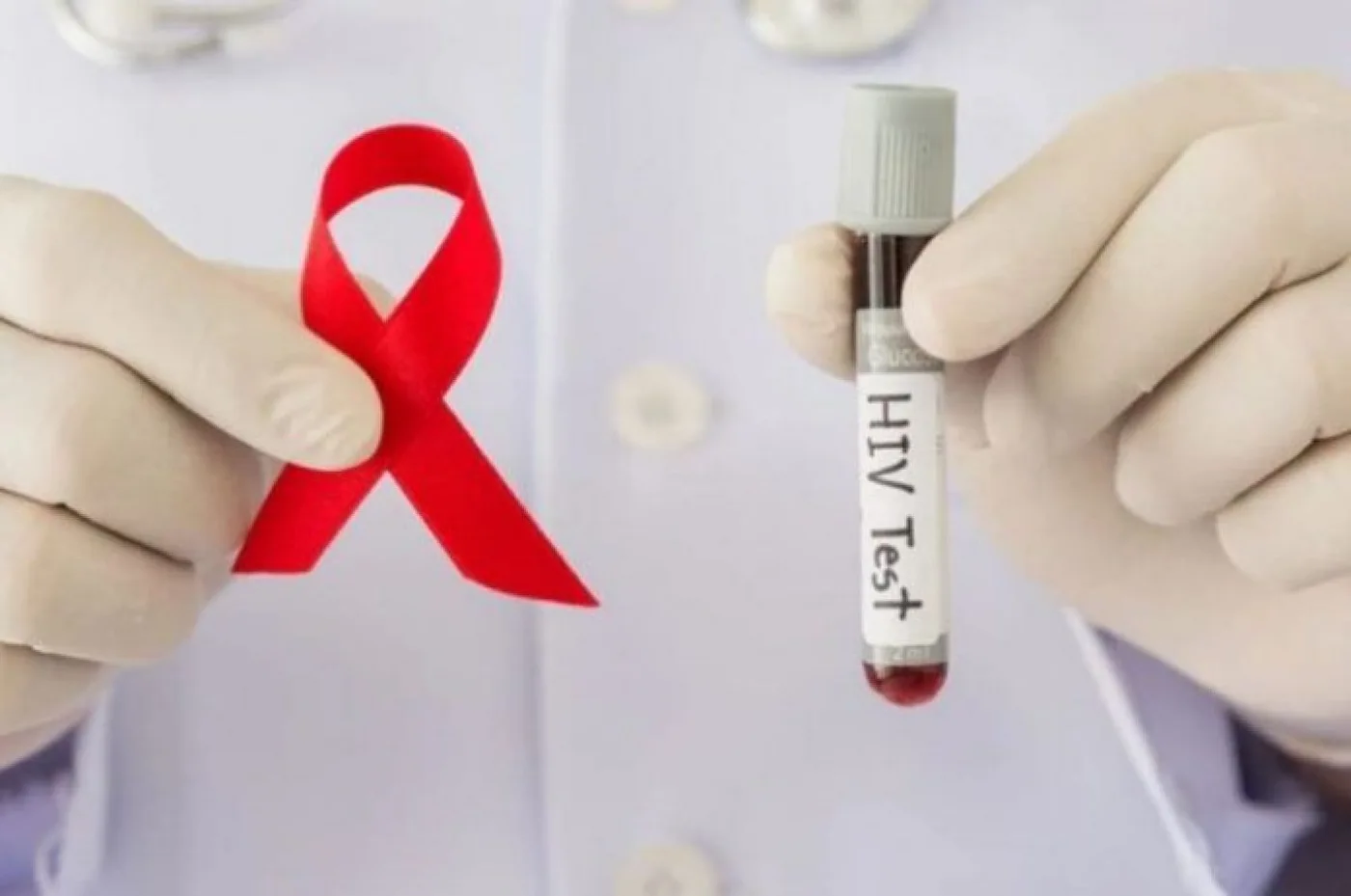 Argentina participará en una prueba para una vacuna preventiva del VIH