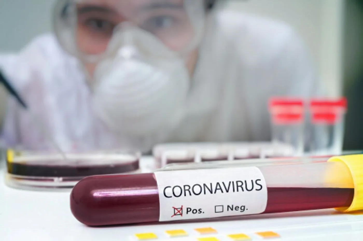 Alerta: Posible caso de coronavirus en Ushuaia