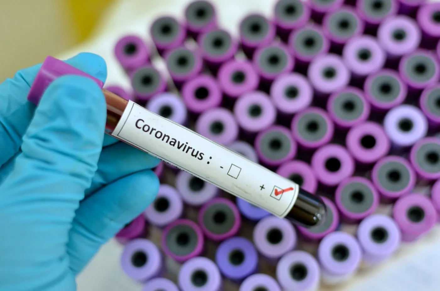 En busca de una solución para el coronavirus