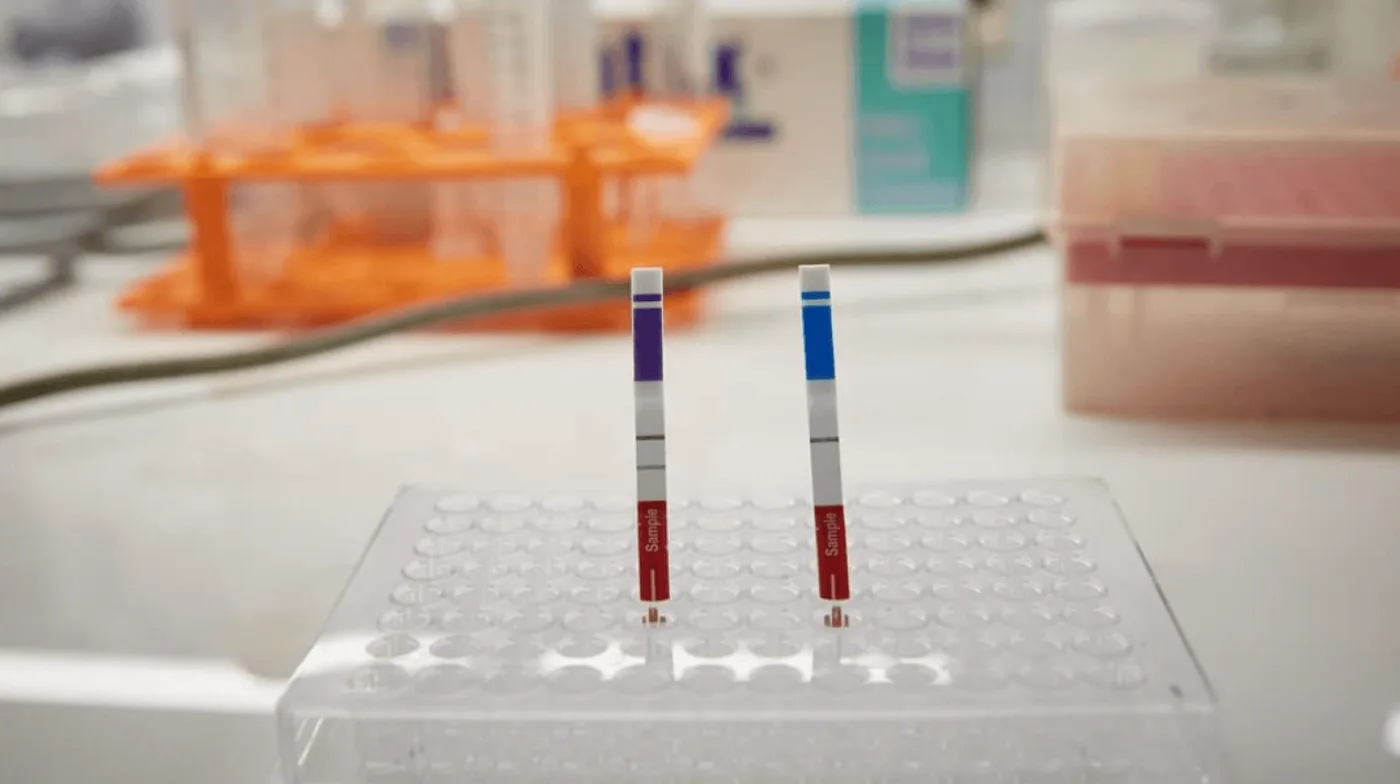 El kit lleva el nombre de “ELA CHEMSTRIP” y ya fue aprobado por la Administración Nacional de Medicamentos, Alimentos y Tecnología Médica (ANMAT).