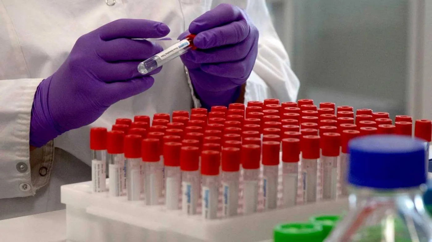 Investigadores argentinos desarrollaron un suero terapéutico anti-COVID-19.