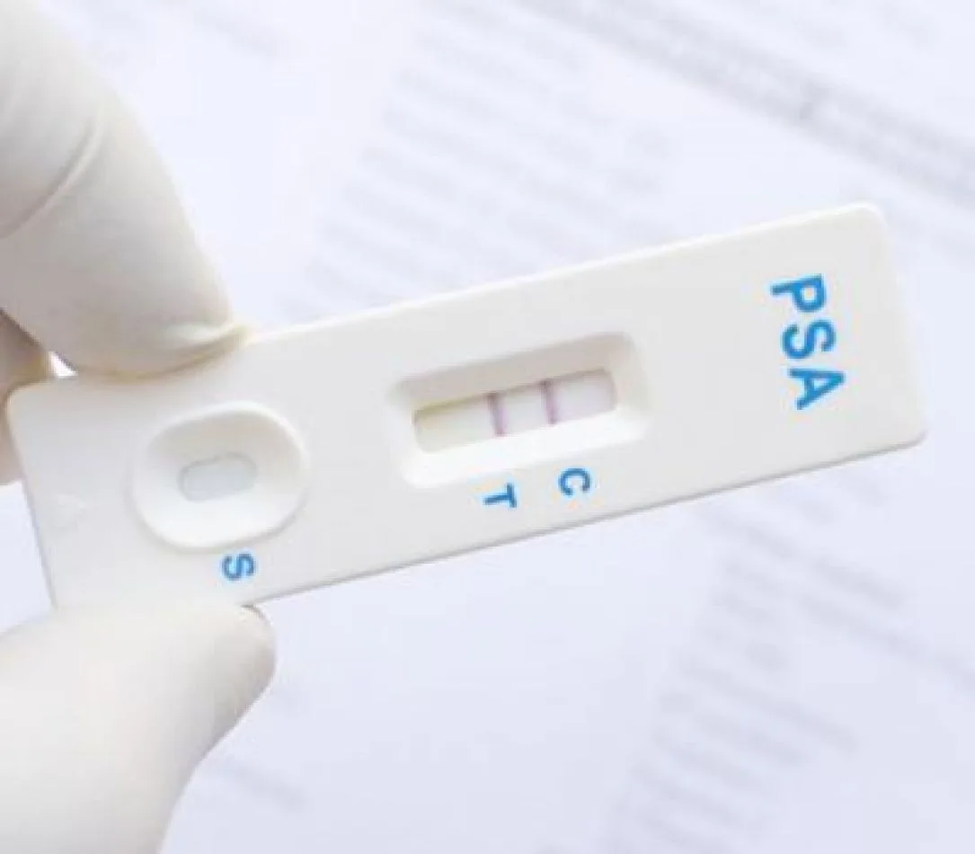 Crean un novedoso test para detectar el cáncer de próstata