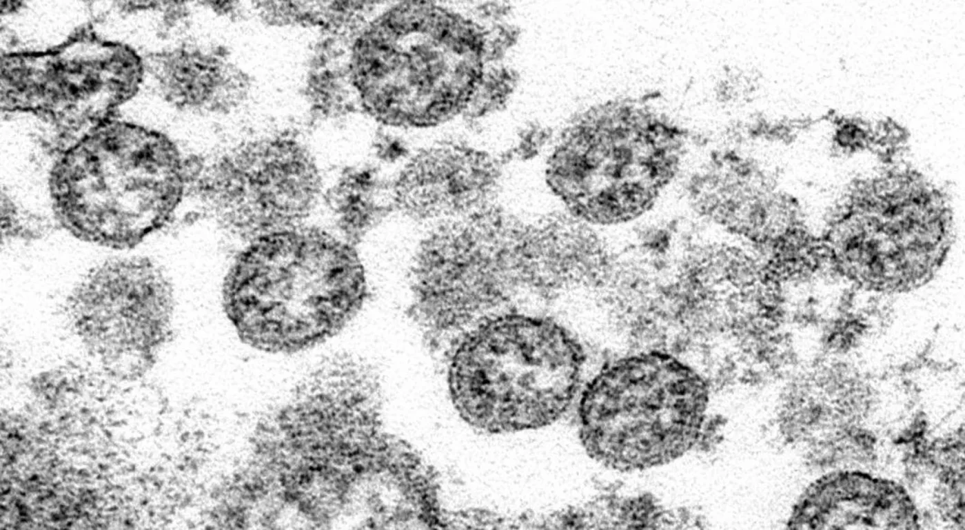 Pandemia. Partículas esféricas de coronavirus vistas a través de un microscopio.
