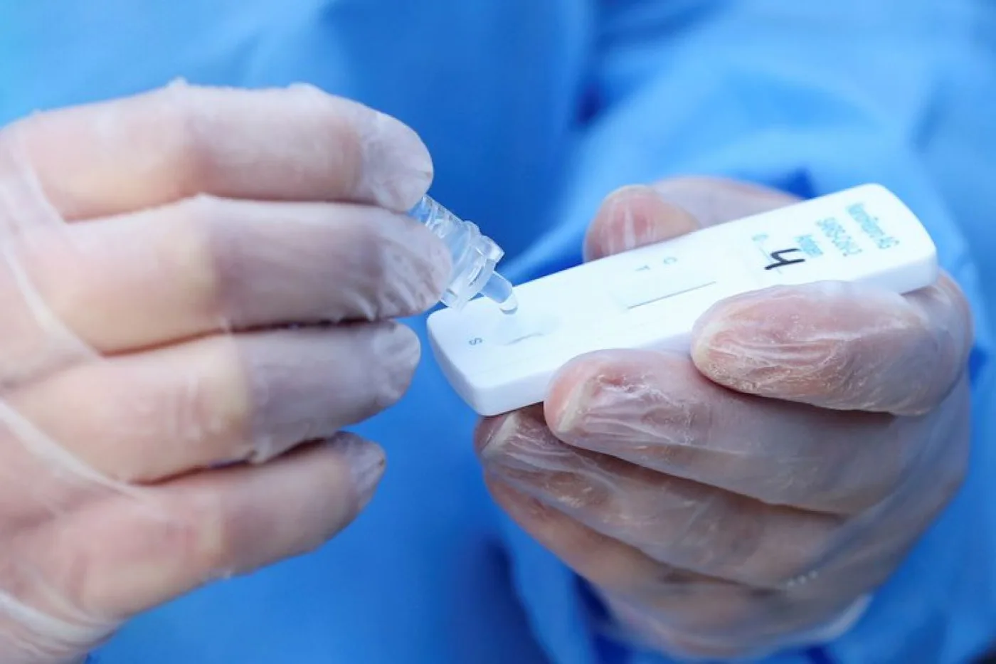 El test tiene un resultado eficaz en sólo 10 minutos -