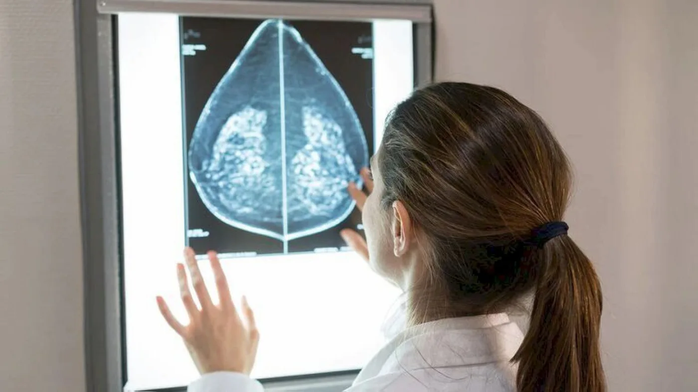 Desarrollan un algoritmo para detectar quiénes necesitan cirugía de cáncer de mama y quiénes no
