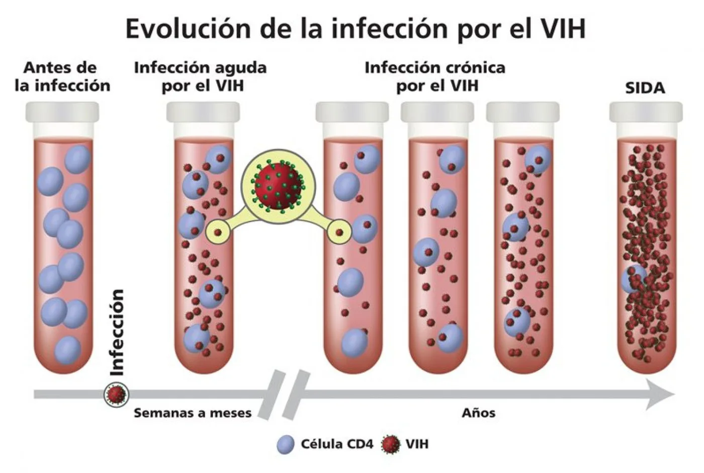 Mujer argentina se convierte en la segunda persona del mundo que se habría curado de VIH por inmunidad natural