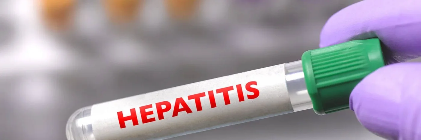 Preocupa el aumento de un tipo de hepatitis aguda en chicos y de origen desconocido