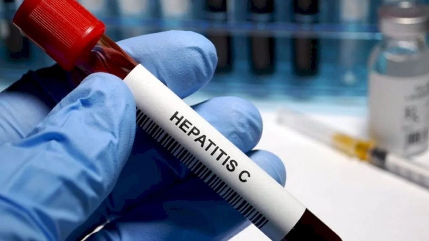 Hepatitis C: Test de detección gratuita en 70 hospitales de todo el país