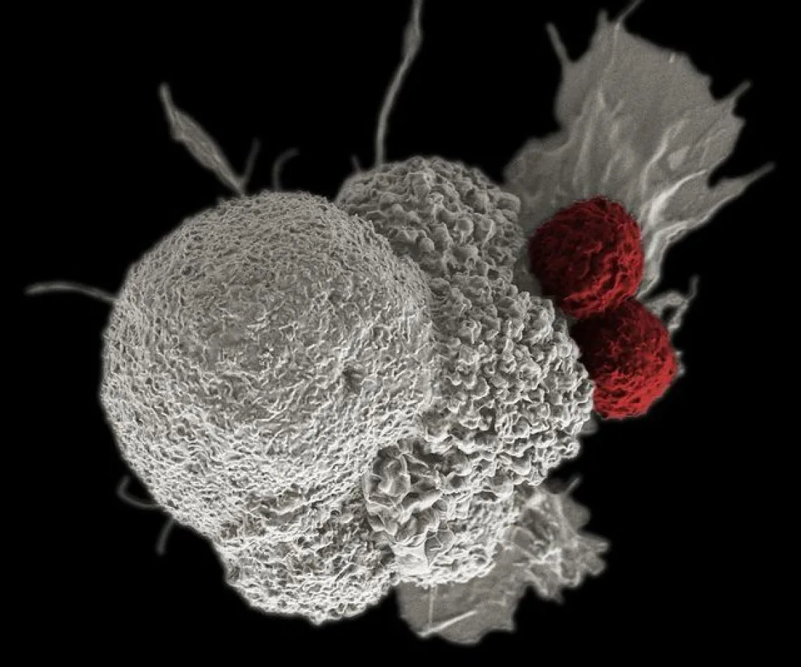 Científicos crearon los linfocitos para el cáncer.