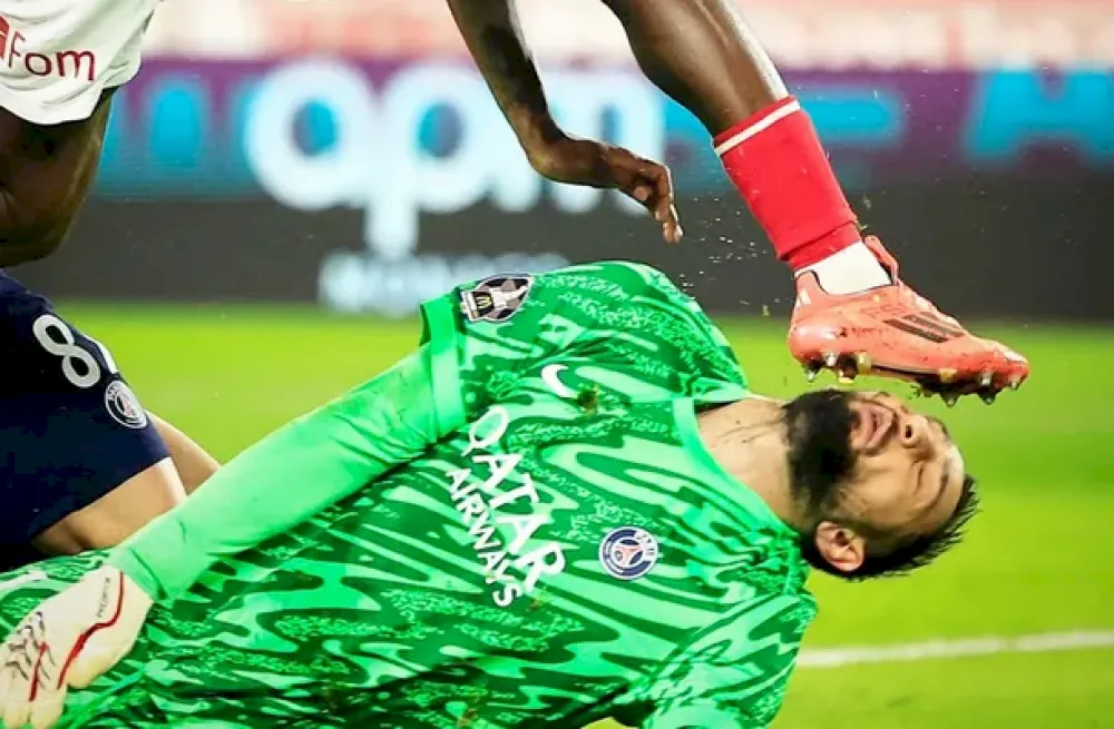 El terrible planchazo en la cara que recibió Donnarumma en Monaco vs. PSG.