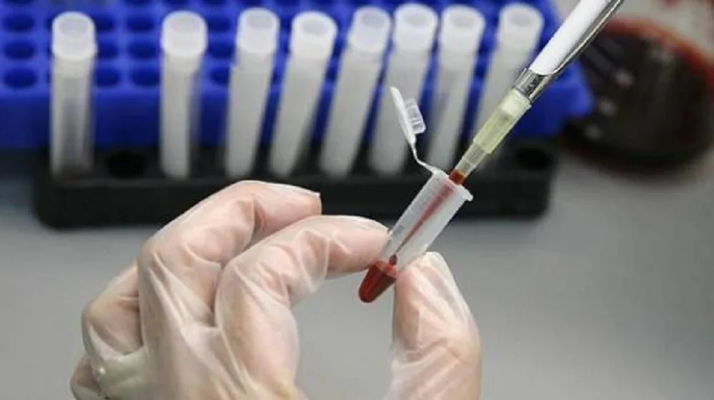 Científicos logran prometedores avances en lucha contra el VIH